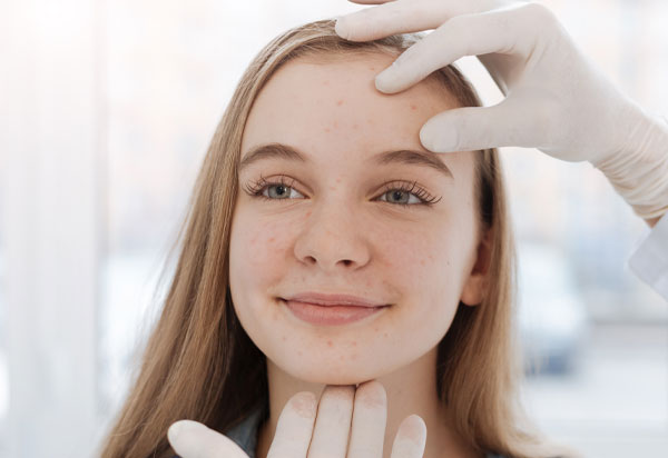 dermatologist examining teen with acne